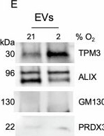 Fig.7.E showing Western Blotting in a Homo sapiens (Human) sample from the publication: HIF-1-regulated TPM3 links hypoxia to motility and invasion beyond the hypoxic fraction in triple-negative breast cancer.