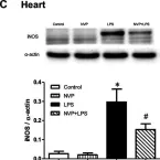 Fig.4.C showing Western Blotting from the publication: The Role of HSP70 in the Protective Effects of NVP-AUY922 on Multiple Organ Dysfunction Syndrome in Endotoxemic Rats.