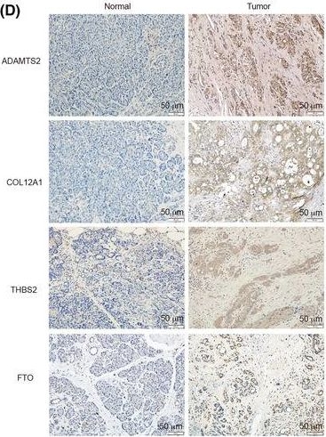 Fig.5.D showing Immunohistochemistry from the publication: N6 -methyladenosine RNA demethylase FTO regulates extracellular matrix-related genes and promotes pancreatic cancer cell migration and invasion.