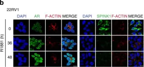 SPINK1 monoclonal antibody (M01), clone 4D4(H00006690-M01) | Abnova