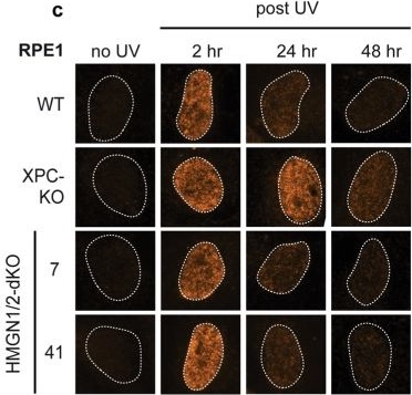 Fig.6.C showing Immunocytochemistry-immunofluorescence from the publication: Human HMGN1 and HMGN2 are not required for transcription-coupled DNA repair.