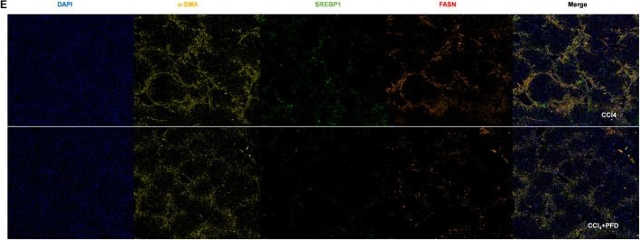 Fig.6.E showing Immunohistochemistry-immunofluorescence in a Homo sapiens (Human) sample from the publication: Pirfenidone Suppresses Liver Fibrosis Through Inhibition of TGF-β-Associated Lipid Metabolic Remodeling in Hepatic Stellate Cells.