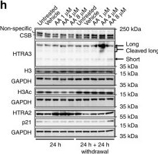 Fig.5.H showing Western Blotting from the publication: CSB promoter downregulation via histone H3 hypoacetylation is an early determinant of replicative senescence.