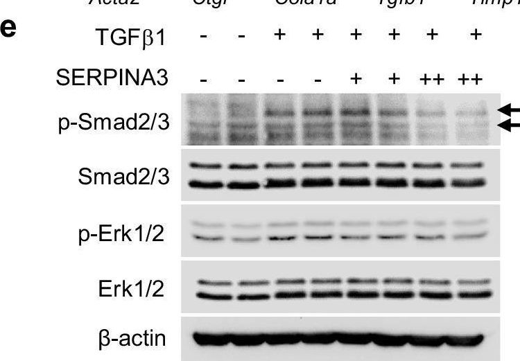 Fig.6.E showing Western Blotting from the publication: Hepatocyte KCTD17-mediated SERPINA3 inhibition determines liver fibrosis in metabolic dysfunction-associated steatohepatitis.