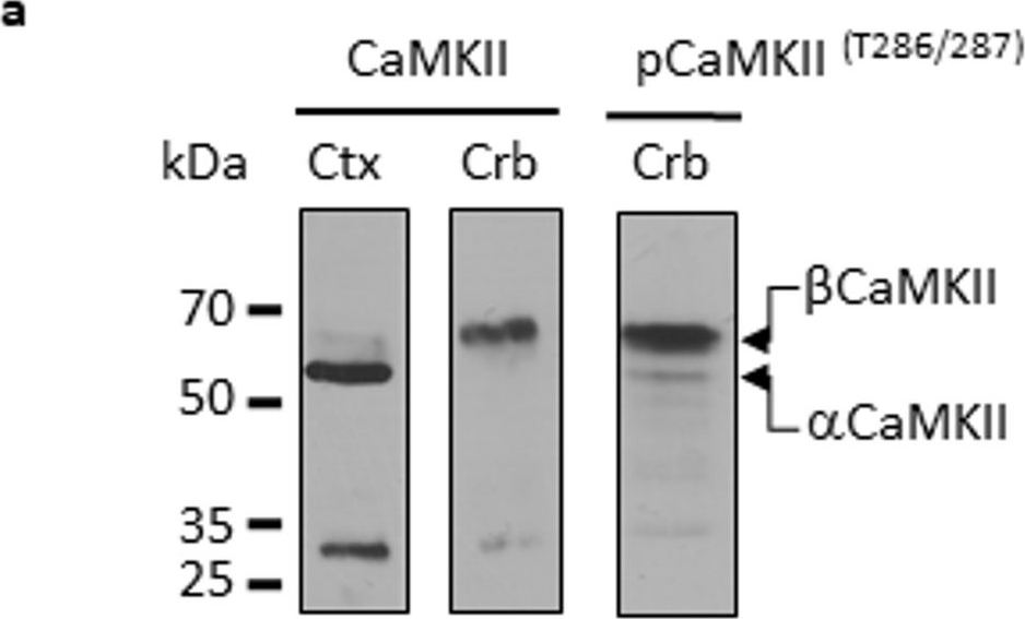 Fig.1.A showing Western Blotting in a Mus musculus (House mouse) sample from the publication: Automated gait analysis indicates efficacy of T-type calcium channel inhibition for mitigation of disrupted calcium signalling in an SCA5 mouse model.