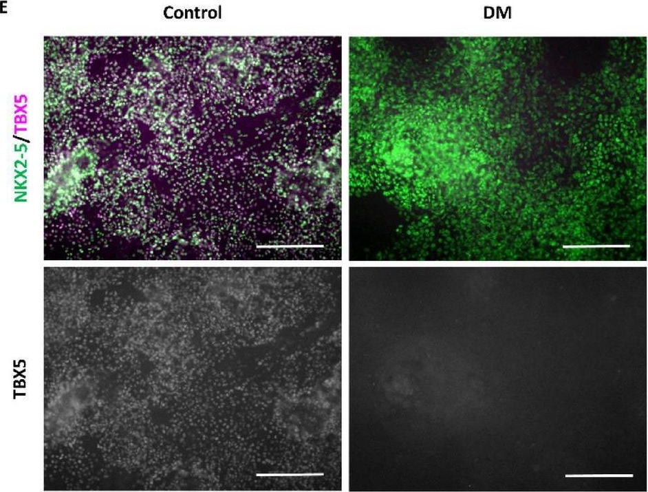 Fig.4.E showing Immunocytochemistry-immunofluorescence in a Homo sapiens (Human) sample from the publication: Specific induction of right ventricular-like cardiomyocytes from human pluripotent stem cells.