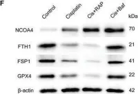 Fig.4.L showing Western Blotting from the publication: FOXO1-NCOA4 Axis Contributes to Cisplatin-Induced Cochlea Spiral Ganglion Neuron Ferroptosis via Ferritinophagy.
