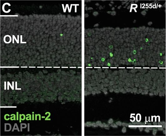 Fig.2.C showing Immunohistochemistry-immunofluorescence in a Mus musculus (House mouse) sample from the publication: Protein kinase G inhibition preserves photoreceptor viability and function in a new mouse model for autosomal dominant retinitis pigmentosa.