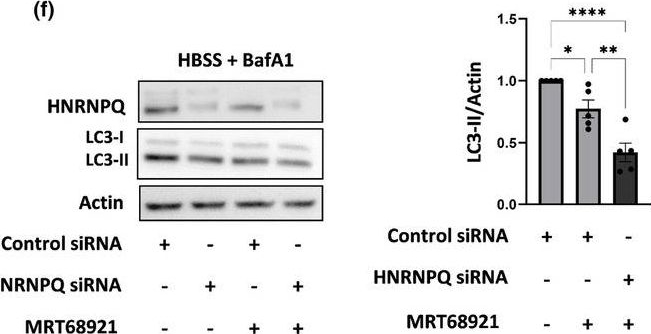 Fig.1.F showing Western Blotting in a Homo sapiens (Human) sample from the publication: Oculopharyngeal muscular dystrophy mutations link the RNA-binding protein HNRNPQ to autophagosome biogenesis.