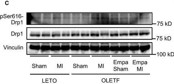 Fig.5.C showing Western Blotting from the publication: Empagliflozin normalizes the size and number of mitochondria and prevents reduction in mitochondrial size after myocardial infarction in diabetic hearts.