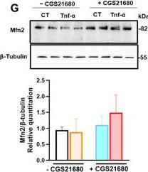 Fig.5.G showing Western Blotting from the publication: Adenosine A2a Receptor Stimulation Mitigates Periodontitis and Is Mitoprotective in Gingival Fibroblasts Promoting Cellular Resilience.