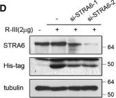 Fig.3.D showing Western Blotting in a Rattus norvegicus (Rat) sample from the publication: Fusion protein of retinol-binding protein and albumin domain III reduces liver fibrosis.