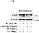Fig.7.G showing Western Blotting from the publication: β-Hydroxybutyrate ameliorates lipopolysaccharide-induced liver injury through β-hydroxybutyrylation of the SOD2 protein in mice.