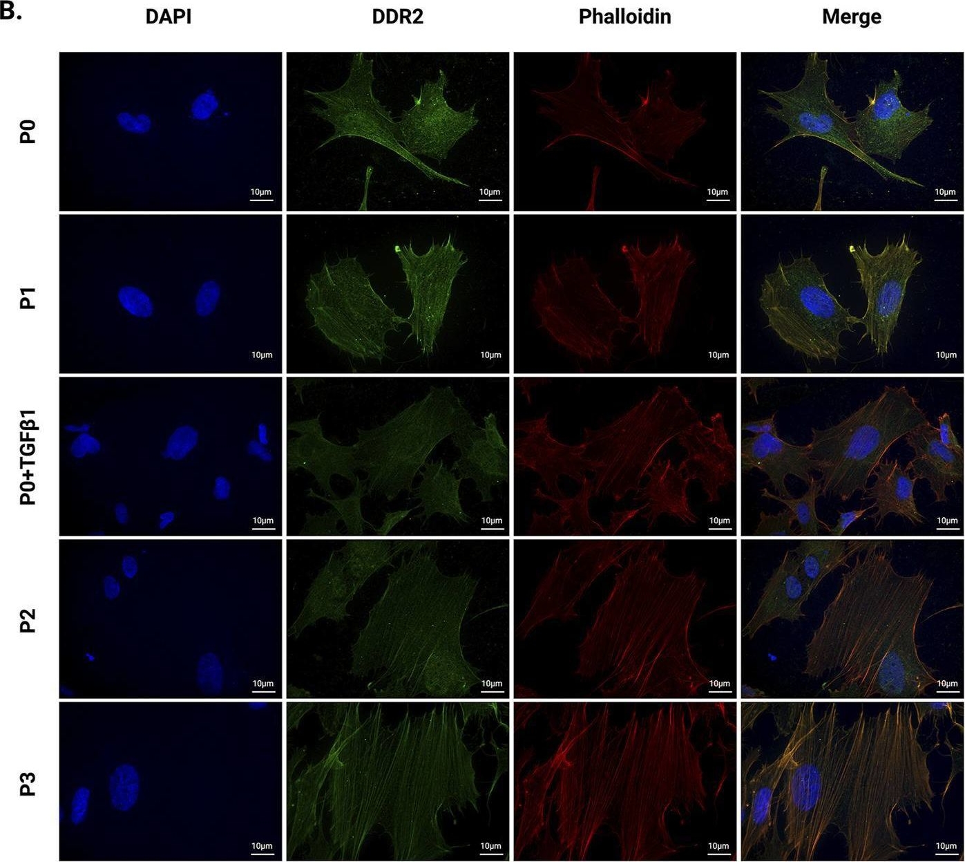 Fig.1.B showing Immunocytochemistry-immunofluorescence in a Homo sapiens (Human) sample from the publication: Molecular and metabolomic characterization of hiPSC-derived cardiac fibroblasts transitioning to myofibroblasts.
