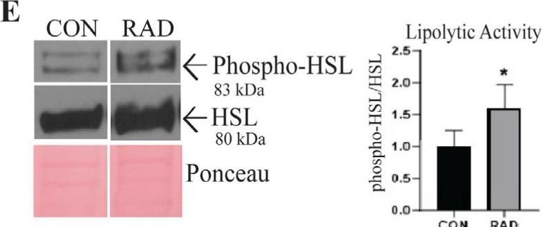 Fig.2.E showing Western Blotting from the publication: Radiation Promotes Acute and Chronic Damage to Adipose Tissue.