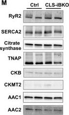 Fig.3.M showing Western Blotting from the publication: Mitochondrial phosphatidylethanolamine modulates UCP1 to promote brown adipose thermogenesis.