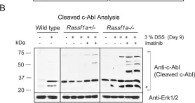 Fig.9.B showing Western Blotting from the publication: The tumor suppressor gene, RASSF1A, is essential for protection against inflammation -induced injury.