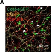 Fig.4.A showing Immunohistochemistry-immunofluorescence from the publication: Bitter taste signaling in tracheal epithelial brush cells elicits innate immune responses to bacterial infection.