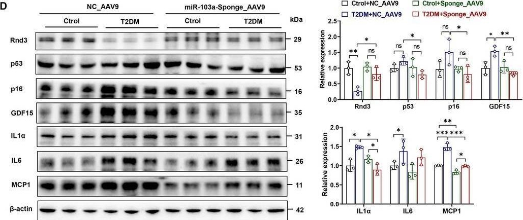 Fig.7.D showing Western Blotting in a Rattus norvegicus (Rat) sample from the publication: Diabetes Advances Cardiomyocyte Senescence Through Interfering Rnd3 Expression and Function.