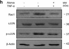 Fig.5.H showing Western Blotting from the publication: Atorvastatin improves spermatogenesis in murine and in vitro human chronic orchitis models through restoring blood-testis barriers.