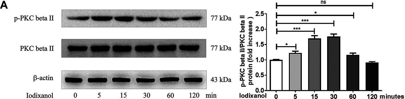 Fig.4.A showing Western Blotting in a Homo sapiens (Human) sample from the publication: D-4F Ameliorates Contrast Media-Induced Oxidative Injuries in Endothelial Cells via the AMPK/PKC Pathway.