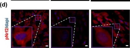 Fig.6.D showing Immunohistochemistry-immunofluorescence from the publication: Placental Growth Factor Secreted from Placenta-Derived Mesenchymal Stem Cells Improves Ovarian Function in TAA-Injured Rats via Antioxidant Effects.