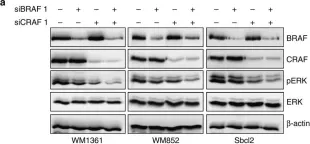 Fig.5.A showing Western Blotting in a Homo sapiens (Human) sample from the publication: RAF proteins exert both specific and compensatory functions during tumour progression of NRAS-driven melanoma.