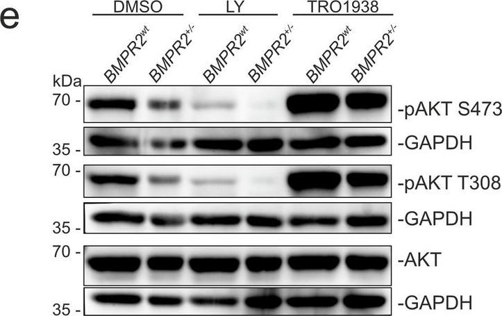 Fig.4.E showing Western Blotting in a Homo sapiens (Human) sample from the publication: Endothelial tip-cell position, filopodia formation and biomechanics require BMPR2 expression and signaling.