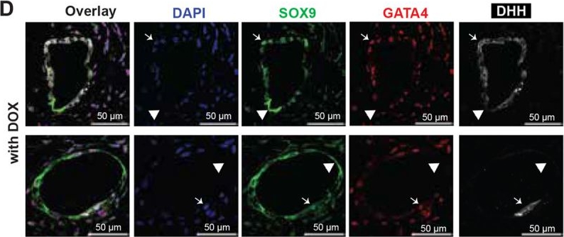 Fig.6.D showing Immunohistochemistry-immunofluorescence in a Homo sapiens (Human) sample from the publication: The emergence of multiple testicular cell lineages in human stem cell-derived testis-like organoids.