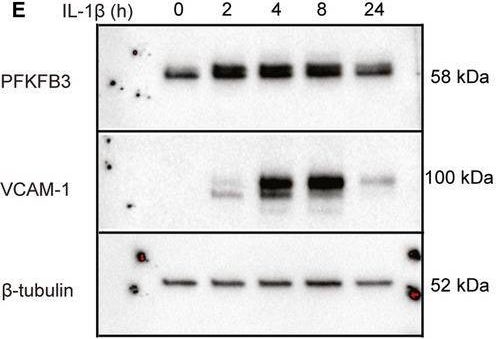 Fig.2.E showing Western Blotting in a Homo sapiens (Human) sample from the publication: Inflammatory activation of endothelial cells increases glycolysis and oxygen consumption despite inhibiting cell proliferation.