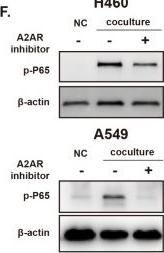 Fig.4.F showing Western Blotting from the publication: A2AR-mediated CXCL5 upregulation on macrophages promotes NSCLC progression via NETosis.