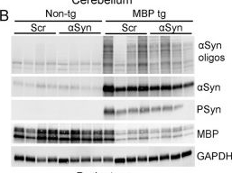 Fig.7.B showing Western Blotting in a Mus musculus (House mouse) sample from the publication: Systemic delivery of anti-sense oligonucleotide targeting α-synuclein for treatment in a mouse model of multiple system atrophy.
