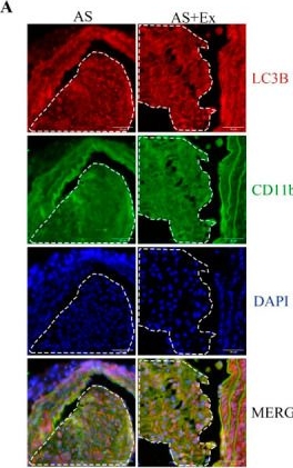 Fig.5.A showing Immunohistochemistry-immunofluorescence in a Mus musculus (House mouse) sample from the publication: Exercise Improves Atherosclerotic Plaque Stability Through Macrophage Autophagy and the FGF21 Signaling Pathway.