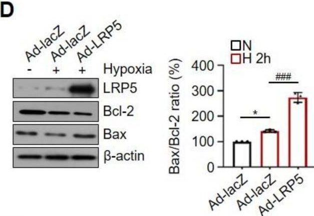 Fig.1.D showing Western Blotting from the publication: LRP5 Regulates HIF-1α Stability via Interaction with PHD2 in Ischemic Myocardium.