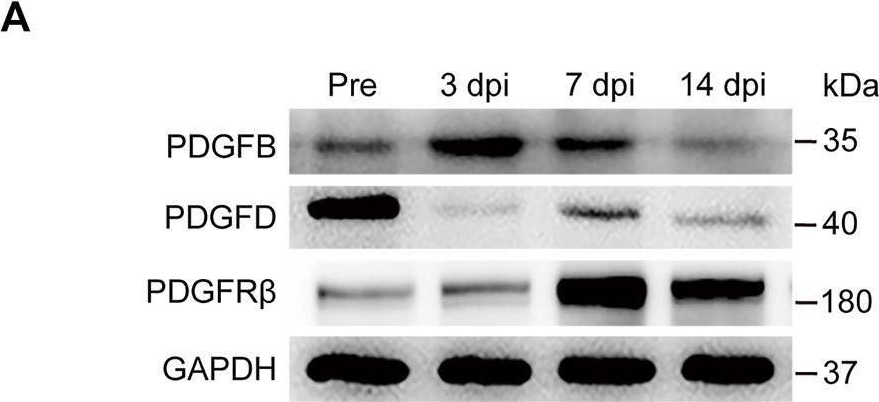 Fig.6.A showing Western Blotting in a Mus musculus (House mouse) sample from the publication: M2 Macrophages Promote PDGFRβ+ Pericytes Migration After Spinal Cord Injury in Mice via PDGFB/PDGFRβ Pathway.