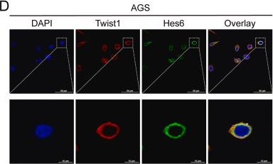 Fig.4.D showing Immunocytochemistry-immunofluorescence from the publication: Transcription cofactor Hes6 interacts with Twist1 to facilitate EMT and promote gastric carcinogenesis by activating the PI3K/AKT signaling.