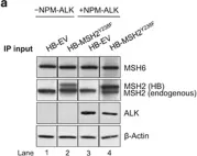 Fig.3.A showing Western Blotting in a Homo sapiens (Human) sample from the publication: NPM-ALK mediates phosphorylation of MSH2 at tyrosine 238, creating a functional deficiency in MSH2 and the loss of mismatch repair.