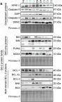 Fig.1.B showing Western Blotting in a Homo sapiens (Human) sample from the publication: The identification of BCL-XL and MCL-1 as key anti-apoptotic proteins in medulloblastoma that mediate distinct roles in chemotherapy resistance.