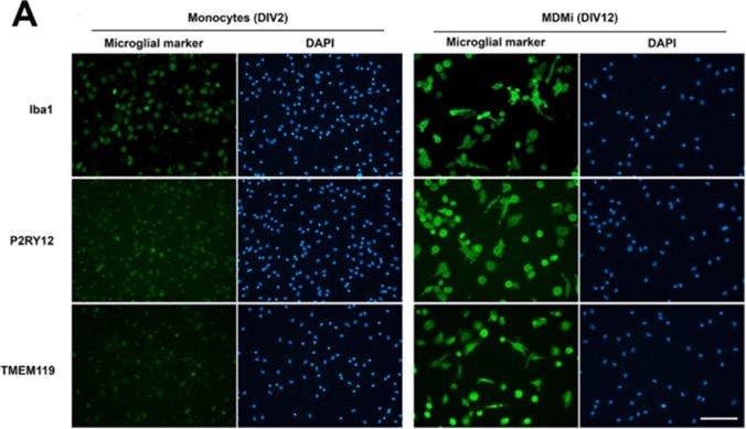 Fig.2.A showing Immunocytochemistry-immunofluorescence in a Homo sapiens (Human) sample from the publication: Human Microglia-Like Cells Differentiated from Monocytes with GM-CSF and IL-34 Show Phagocytosis of α-Synuclein Aggregates and C/EBPβ-Dependent Proinflammatory Activation.