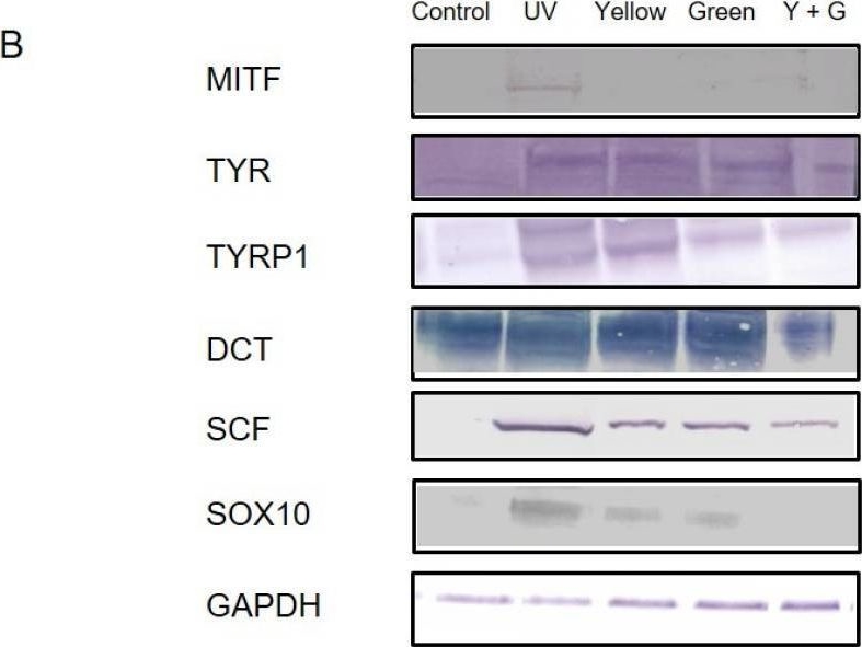 Fig.5.B showing Western Blotting in a Homo sapiens (Human) sample from the publication: Intense Pulsed Light Attenuates UV-Induced Hyperimmune Response and Pigmentation in Human Skin Cells.
