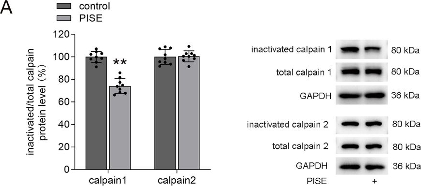 Fig.1.A showing Western Blotting in a Mus musculus (House mouse) sample from the publication: Transient receptor potential vanilloid 4 blockage attenuates pyroptosis in hippocampus of mice following pilocarpine‑induced status epilepticus.