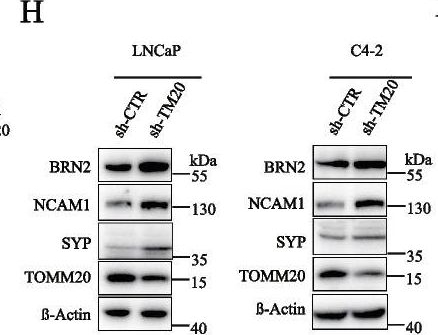 Fig.7.H showing Western Blotting from the publication: AR antagonists develop drug resistance through TOMM20 autophagic degradation-promoted transformation to neuroendocrine prostate cancer.