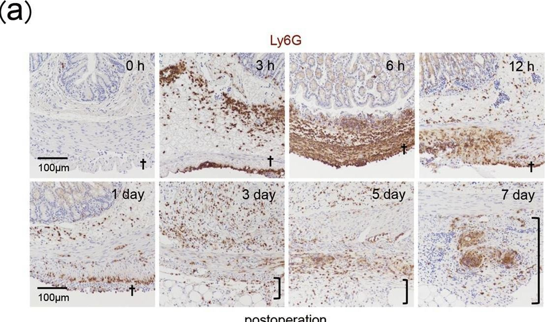 Fig.3.A showing Immunohistochemistry from the publication: Anti-interleukin-6 receptor antibody treatment ameliorates postoperative adhesion formation.