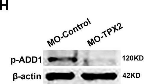 Fig.7.T showing Western Blotting in a Mus musculus (House mouse) sample from the publication: Phosphorylation of adducin-1 by TPX2 promotes interpolar microtubule homeostasis and precise chromosome segregation in mouse oocytes.