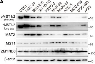 Fig.8.A showing Western Blotting in a Homo sapiens (Human) sample from the publication: Combinatorial targeting of Hippo-STRIPAK and PARP elicits synthetic lethality in gastrointestinal cancers.