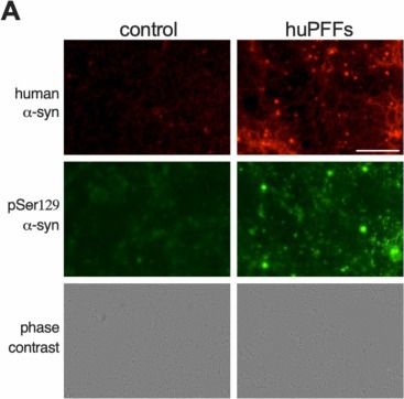 Fig.2.A showing Immunocytochemistry-immunofluorescence in a Rattus norvegicus (Rat) sample from the publication: Queuine, a bacterial-derived hypermodified nucleobase, shows protection in in vitro models of neurodegeneration.