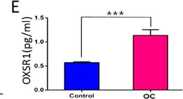 Fig.5.M showing Enzyme-linked immunosorbent assay from the publication: Oral Microbiome and CPT1A Function in Fatty Acid Metabolism in Oral Cancer.