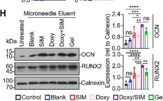 Fig.5.H showing Western Blotting in a Mus musculus (House mouse) sample from the publication: Core-shell microneedles Co-loaded with simvastatin and doxycycline for combined anti-infection and osteogenesis in diabetic periodontitis.