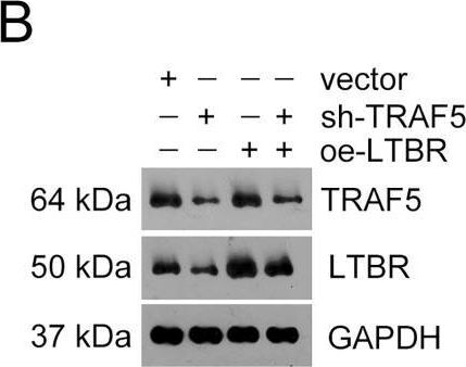 Fig.5.B showing Western Blotting in a Homo sapiens (Human) sample from the publication: Silencing of TRAF5 enhances necroptosis in hepatocellular carcinoma by inhibiting LTBR-mediated NF-κB signaling.