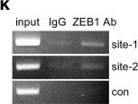 Fig.1.K showing Western Blotting from the publication: Hyaluronan network remodeling by ZEB1 and ITIH2 enhances the motility and invasiveness of cancer cells.